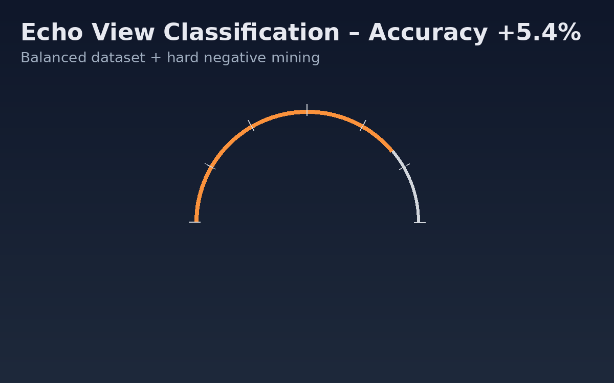 Echo View Classification