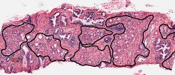 Histopathology
