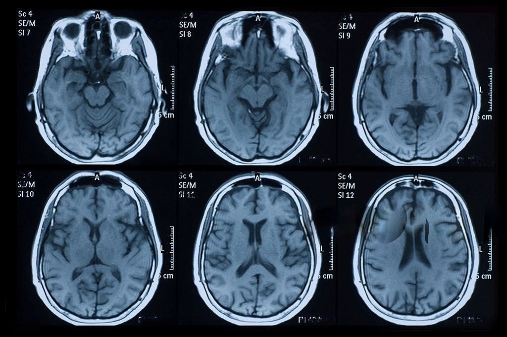 MRI Annotation