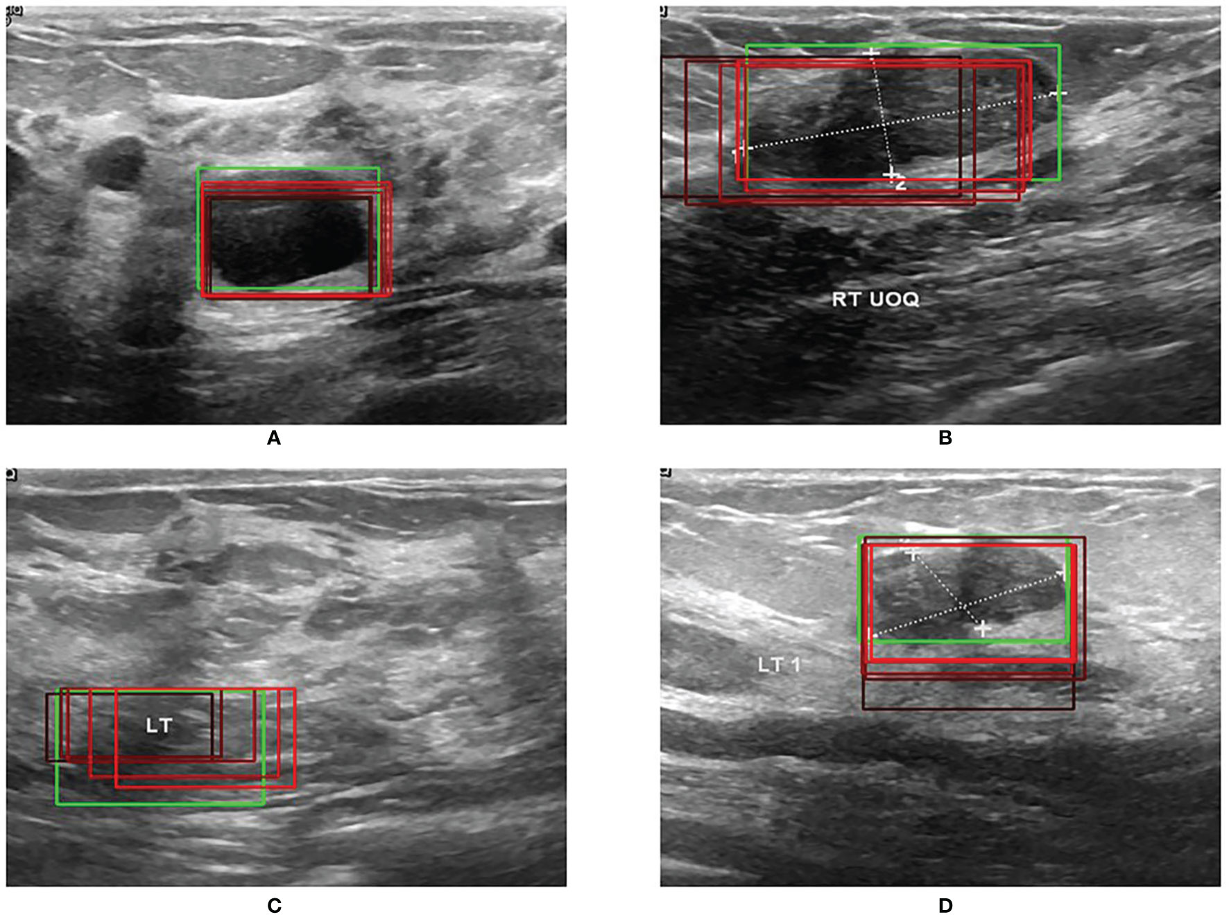 Ultrasound Annotation